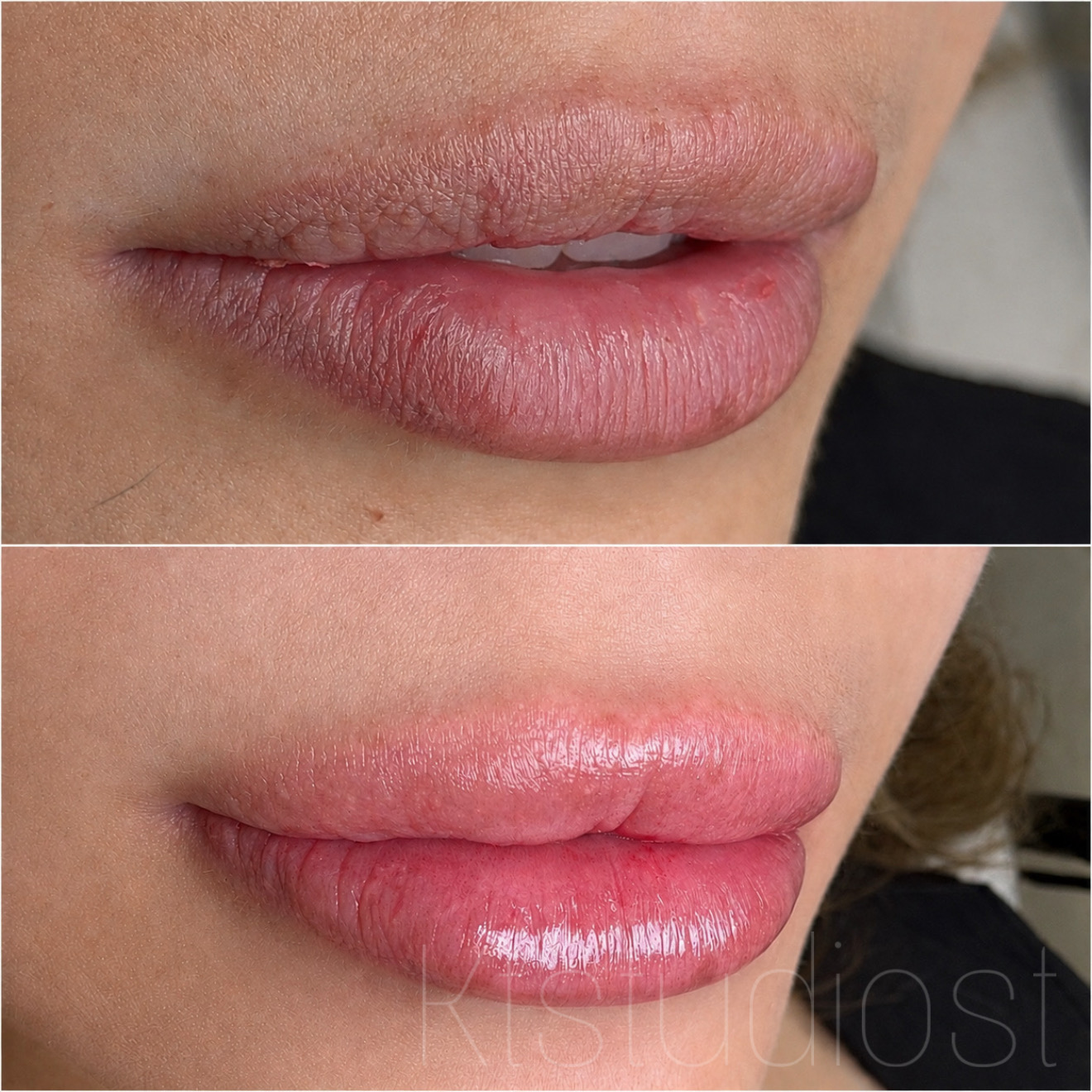 Hydracolor Lips